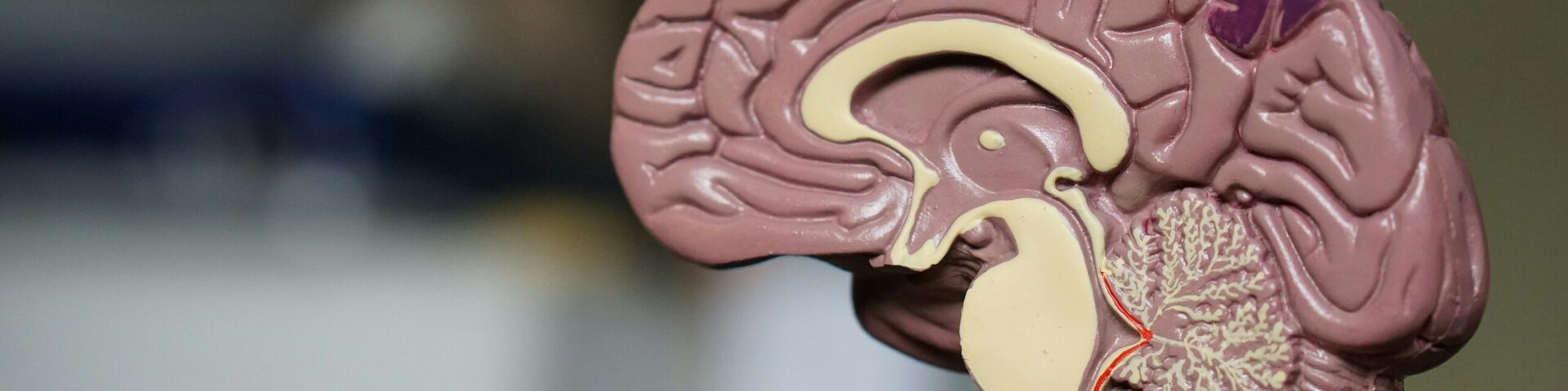 Tartu Ülikooli teadlased avastasid uue ravimikandidaadi agressiivse ajukasvajaga võitlemiseks